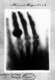 Hand mit Ringen: print of Wilhelm Rntgen's first "medical" x-ray, of his wife's hand, taken on 22 December 1895 and presented to Professor Ludwig  Zehnder of the Physik Institut, University of Freiburg, on 1 January 1896