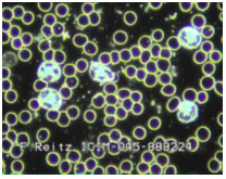 Ultra-Darkfield Microscopy