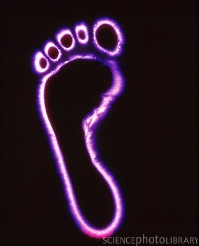 Kirlian photograph of a human foot