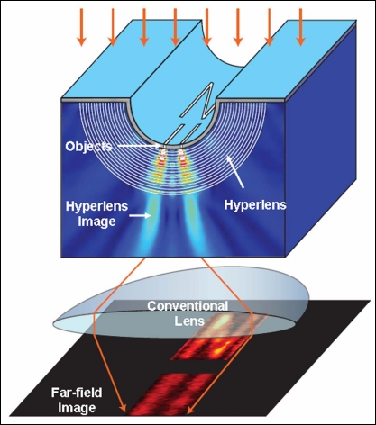 Zhang's hyperlens