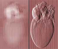 X-ray radiography of a rat heart: left with conventional absorption contrast and right, with phase-contrast (image field 14 x 25 mm)