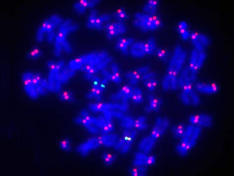 Uvnit bunnho jdra je veker genetick informace soustedna do molekul DNA, "zabalench" do chromozm.