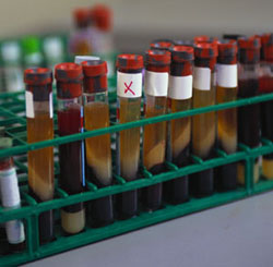 Blood samples in test tubes