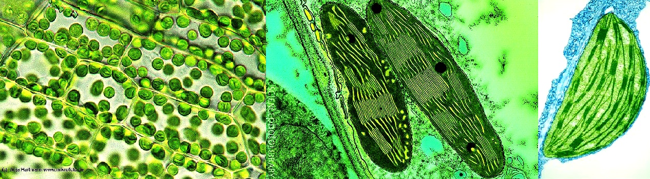 http://www.sciencephoto.com/image/10699/530wm/B1100043-Chloroplasts_from_a_pea_plant-SPL.jpg