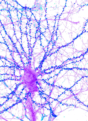 http://www.neurosignallab.com/images/PI3K%20and%20synapses-1.jpg