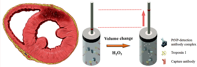 http://upload.wikimedia.org/wikipedia/commons/9/92/Heart_ant_wall_infarction.jpg