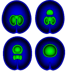 http://francis.naukas.com/files/2009/07/dibujo20090716_particle_density_at_different_stages_of_monopole_formation_and_unwinding_of_monopole_defect.jpg