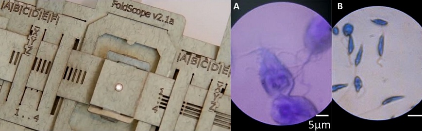 http://www.wired.com/images_blogs/wiredscience/2014/03/foldscope-660x371.jpg