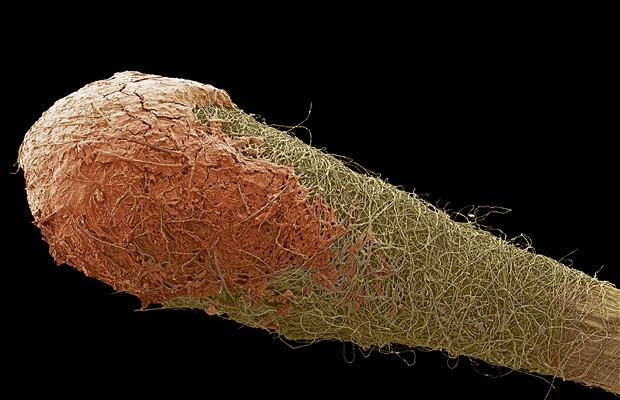 Coloured scanning electron micrograph (SEM) of ear wax (brown) collected on cotton bud fibres (green). Ear wax forms in the ear canal, which runs between the outer ear and the ear drum. Ear wax, or cerumen, is produced by glands in the wall of the ear canal. It prevents the entry of bacteria and foreign objects that could damage the ear. Photo: Power And Syred/Science Photo Library