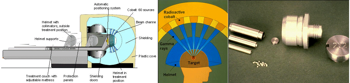 http://www.lowback-pain.com/imagesfolder/gamma%2014.jpg